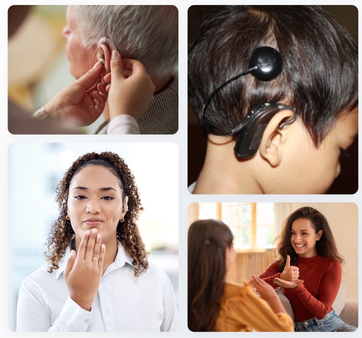 collage of four images: fitting a hearing aid, electrodes on the back of a head, person signing, couple communicating with sign language and smiling